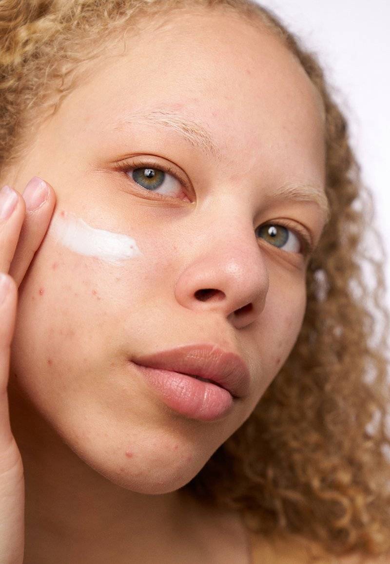 The Ordinary The Ordinary Serum Heißer Verkauf